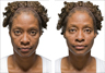 Before & After Photos